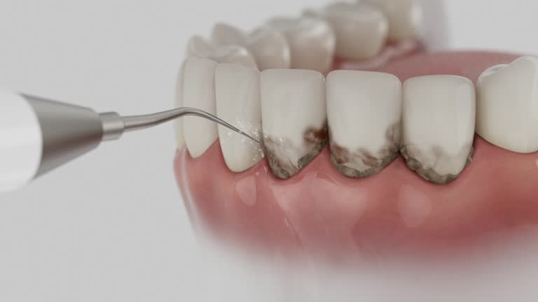 Reliable Dental Implants contractor in Val Verde Park, TX by Smile Center Dentistry